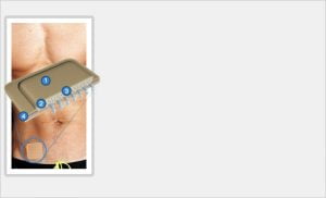How to use ProEnhance Patch
